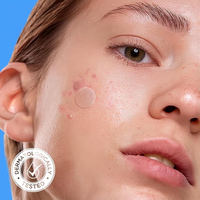 AVARELLE Pimple Patches for Face | Hydrocolloid Acne Patches for Covering Blemishes | FSA HSA Zit Patches with Tea Tree, Calendula, & Cica | HSA Store Eligible Items (10-14 mm, 80 Count)