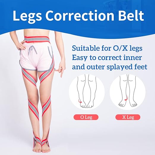 GHORTHOUD O/X Legs Correction Belt Legs Posture Corrector Band Unisex O/X Legs Type Legs Bandage Lightweight Pediatric Straighten Belt for Men Women and Children for Day and Night (Medium)
