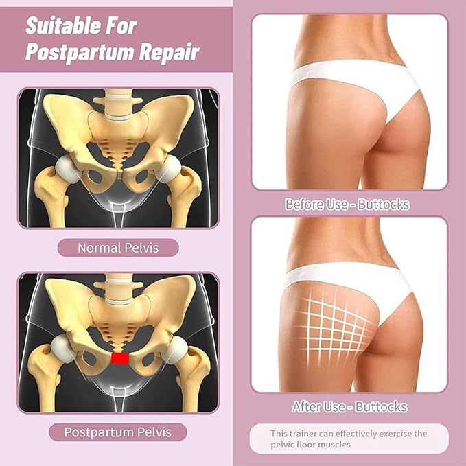 Thigh Exerciser, Upgraded Thigh Master, Inner Thigh Exercise